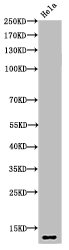 Acetyl-Histone H4 (K5) antibody