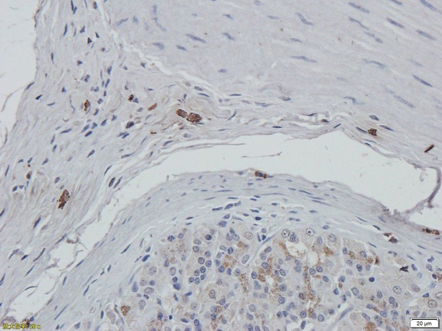 Acetylhydrolase PAF Rabbit Polyclonal Antibody
