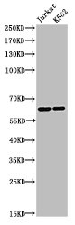 Acetyl-RELA (K218) antibody
