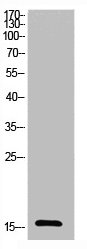 Acetyl-UBA52/RPS27A/UBB/UBC (K27) Antibody