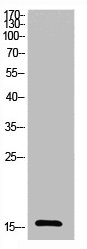 Acetyl-UBA52 (K27) antibody