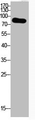 Acetyl-UBA52 (K29) antibody