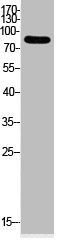 Acetyl-UBA52/RPS27A/UBB/UBC (K33) Antibody