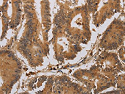 ACHE Antibody