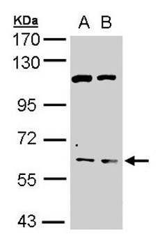 AChE antibody