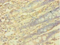PICK1 Antibody