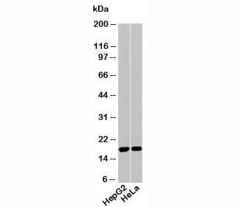 Acid Phosphatase Antibody (Isoform 2 specific)