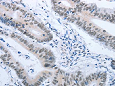 ACIN1 Antibody