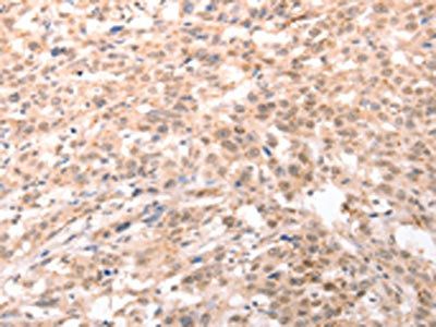 ACIN1 Antibody