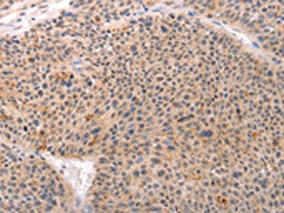 ACIN1 Antibody