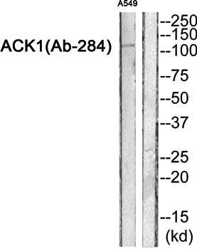 ACK1 antibody