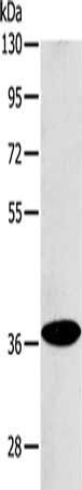 ACMSD antibody