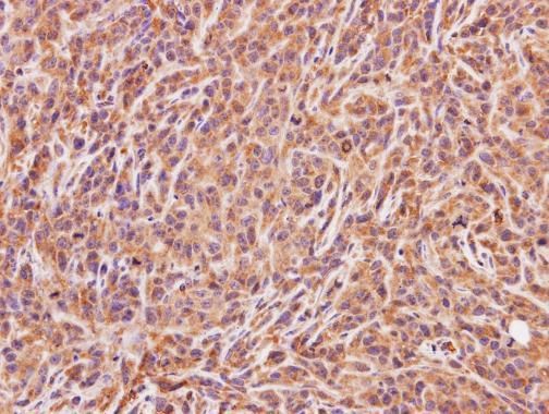 ACMSD antibody [N2C3]