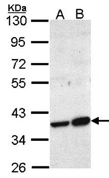 ACMSD antibody