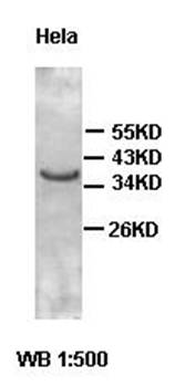ACMSD antibody