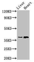 ACMSD Antibody