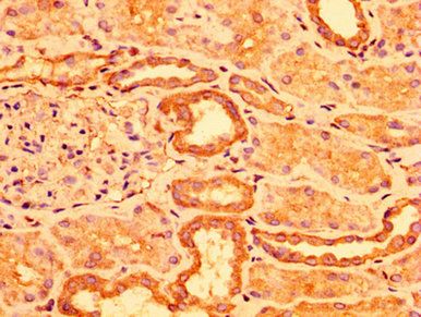 ACOT1 Antibody