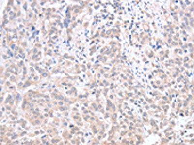 ACOT1 Antibody