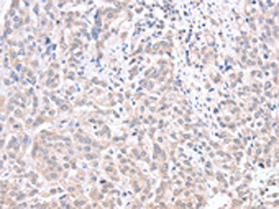 ACOT1 antibody