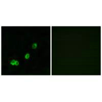 ACOT1 Antibody