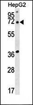 ACOT11 antibody