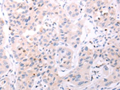 ACOT2 Antibody