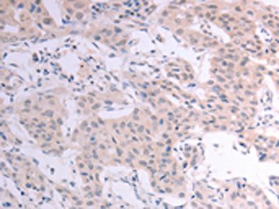 ACOT2 Antibody