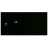 ACOT4 Antibody