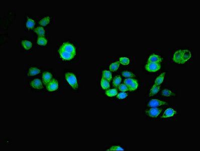 ACOT6 antibody