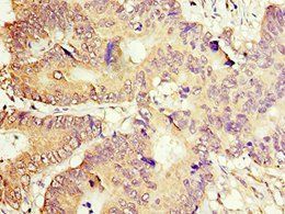 ACOT7 Antibody