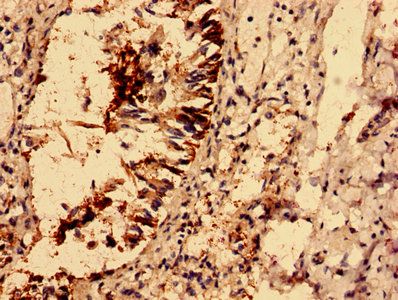 ACOT9 Antibody