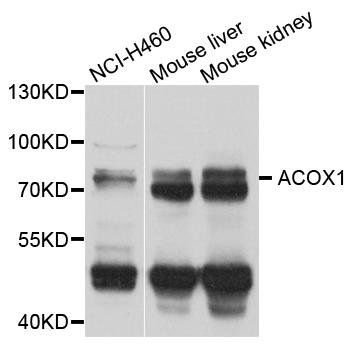 ACOX1 antibody