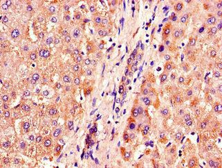 ACOX1 Antibody