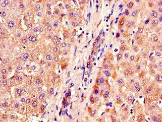 ACOX1 antibody