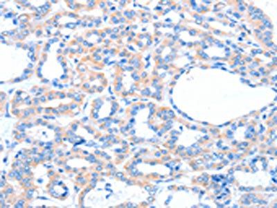 ACOX1 Antibody