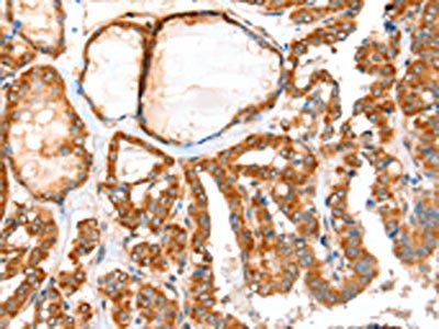 ACOX1 Antibody