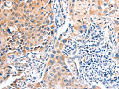 ACOX2 Antibody