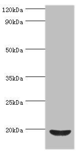 ACP1 antibody