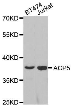 ACP5 antibody