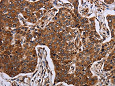 ACP6 antibody