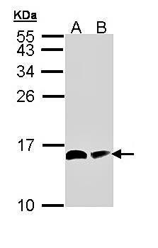 ACP antibody