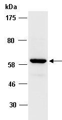 ACPP1 (C) Antibody, Rabbit Polyclonal