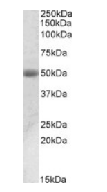 Goat anti-ACPP / PAP (aa269-282), Biotinylated Antibody