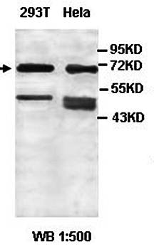 ACRBP Rabbit Polyclonal Antibody