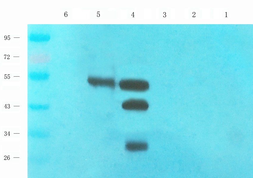 Acrosin antibody