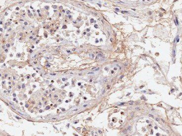 Goat anti-Acrosin light chain Antibody