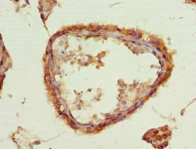 ACSBG2 Antibody
