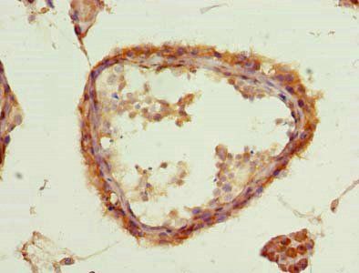 ACSBG2 antibody