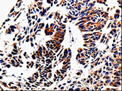 ACSBG2 Antibody