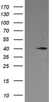 ACSF2 antibody